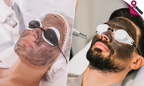 Carbon Laser Facial Treatment for Ladies & Men!